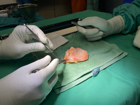 Meniskus Transplantat