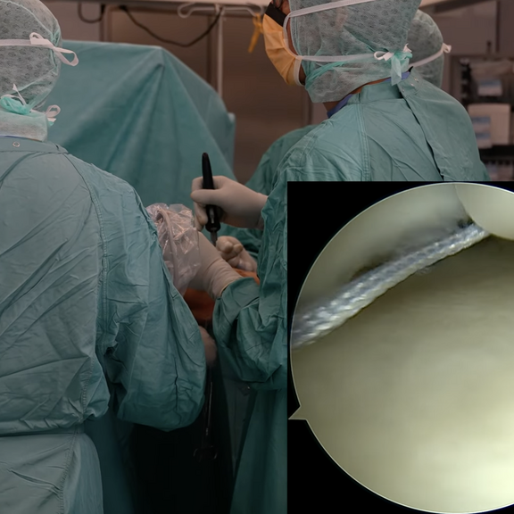 Arthroskopie Dr Brandl Arthroskopie Dr Brandl