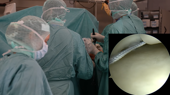 Arthroskopie Dr Brandl Arthroskopie Dr Brandl