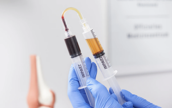 PRP ACP Plasma PRP ACP Plasma