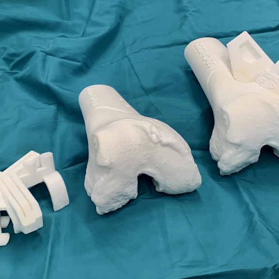 Osteotomie Modelle 3D Druck