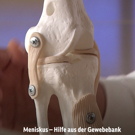 ORF Bewusst Gesund Beitrag Meniskus